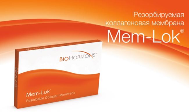 Коллагеновая мембрана Mem-Lok от BioHorizons