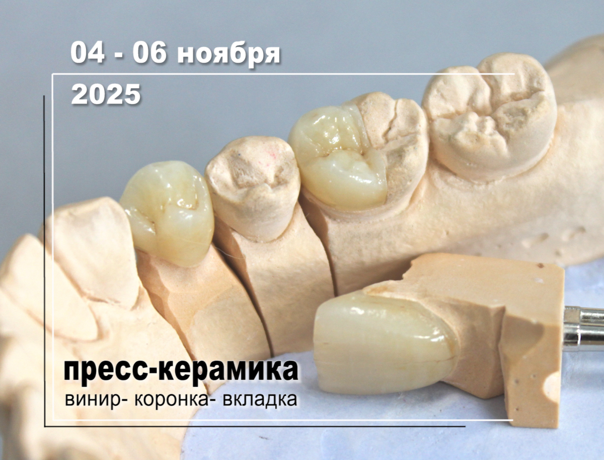Технология создания виниров, коронок, вкладок Inlay/Onlay из пресс-керамики E-max