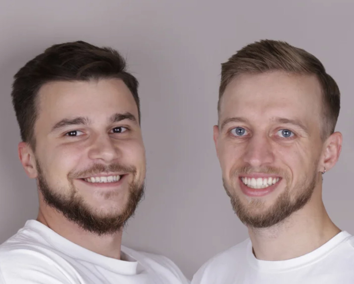 Тотальные работы на имплантах