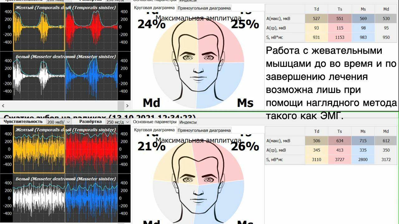 «Заниматься или лечить ВНЧС»