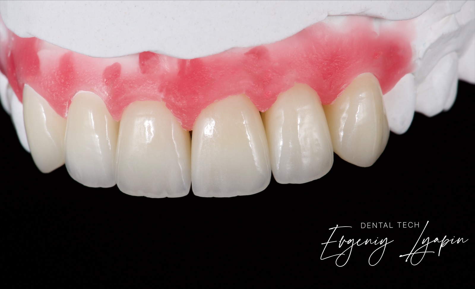 «Авторский курс от Евгения Ляпина по теме: Изготовление циркониевых коронок по концепции BOPT. На примере масс e.max и creation»