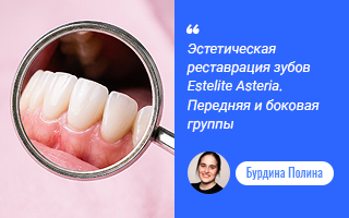 Эстетическая реставрация зубов Estelite Asteria. Передняя и боковая группы