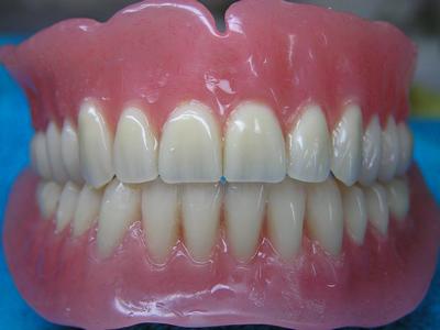 Зубные протезы: виды, описание, рекомендации, стоимость