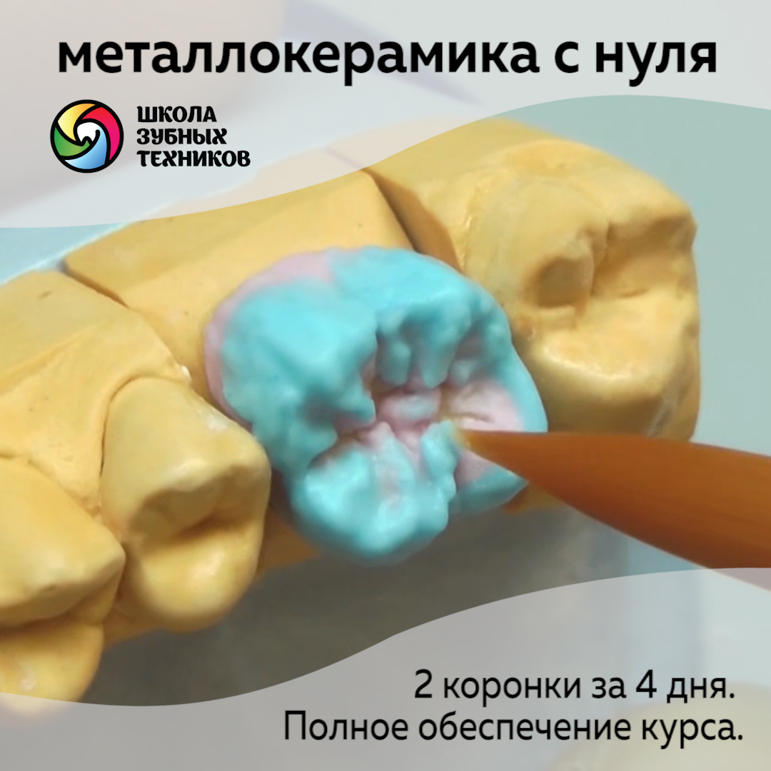 Изготовление металлокерамических коронок. База