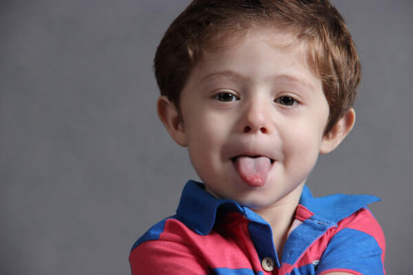 Слишком короткая уздечка языка в детской стоматологии