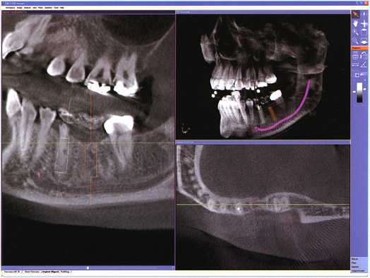 Снимок зубов 3D
