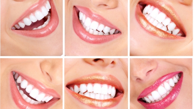 Командный метод в эстетической стоматологии