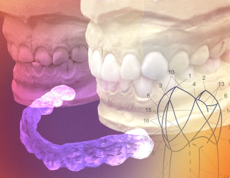 Стираемость: восстановление анатомической формы зубных рядов. Основы практической гнатологии, артикуляции и сплинт терапии для стоматологов терапевтов и ортопедов