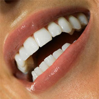 Нейлоновые зубные протезы: преимущества и недостатки