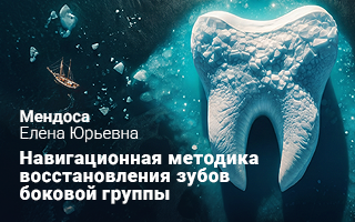 Навигационная методика восстановления окклюзионных поверхностей зубов боковой группы