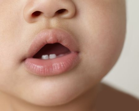 Первые зубы у детей