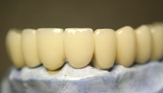 Как появились зубные протезы, или зачем красавице веер?