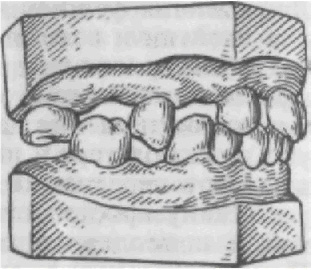 Деформации зубных рядов