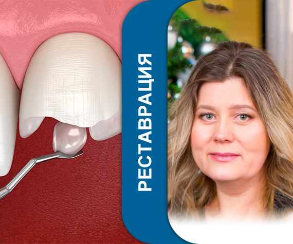Инновационные подходы в композитном восстановлении передних зубов: инъекционная, флоу и комбинированная методики. Практический курс