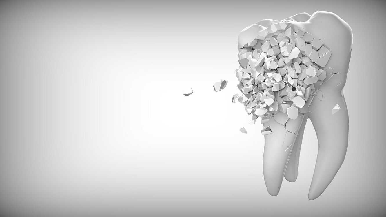 Опасные «незнакомки» в стоматологии. Сочетанные эндоперио поражения. Резорбции твердых тканей зуба