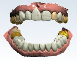 Сканер Lava™ сможет работать с цифровой системой 3Shape's Dental SystemTM