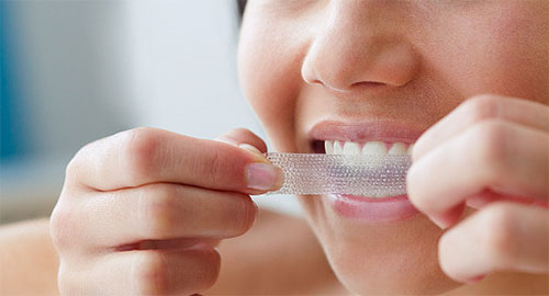 Отбеливание зубов - плюсы и минусы.