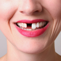 От чего выпадают зубы?