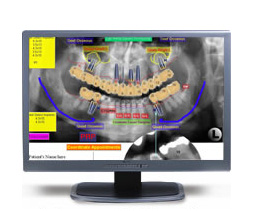 Zimmer Dental и XCPT стали партнерами