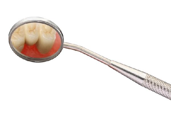 Структура врачебной местной профилактики стоматологических заболеваний