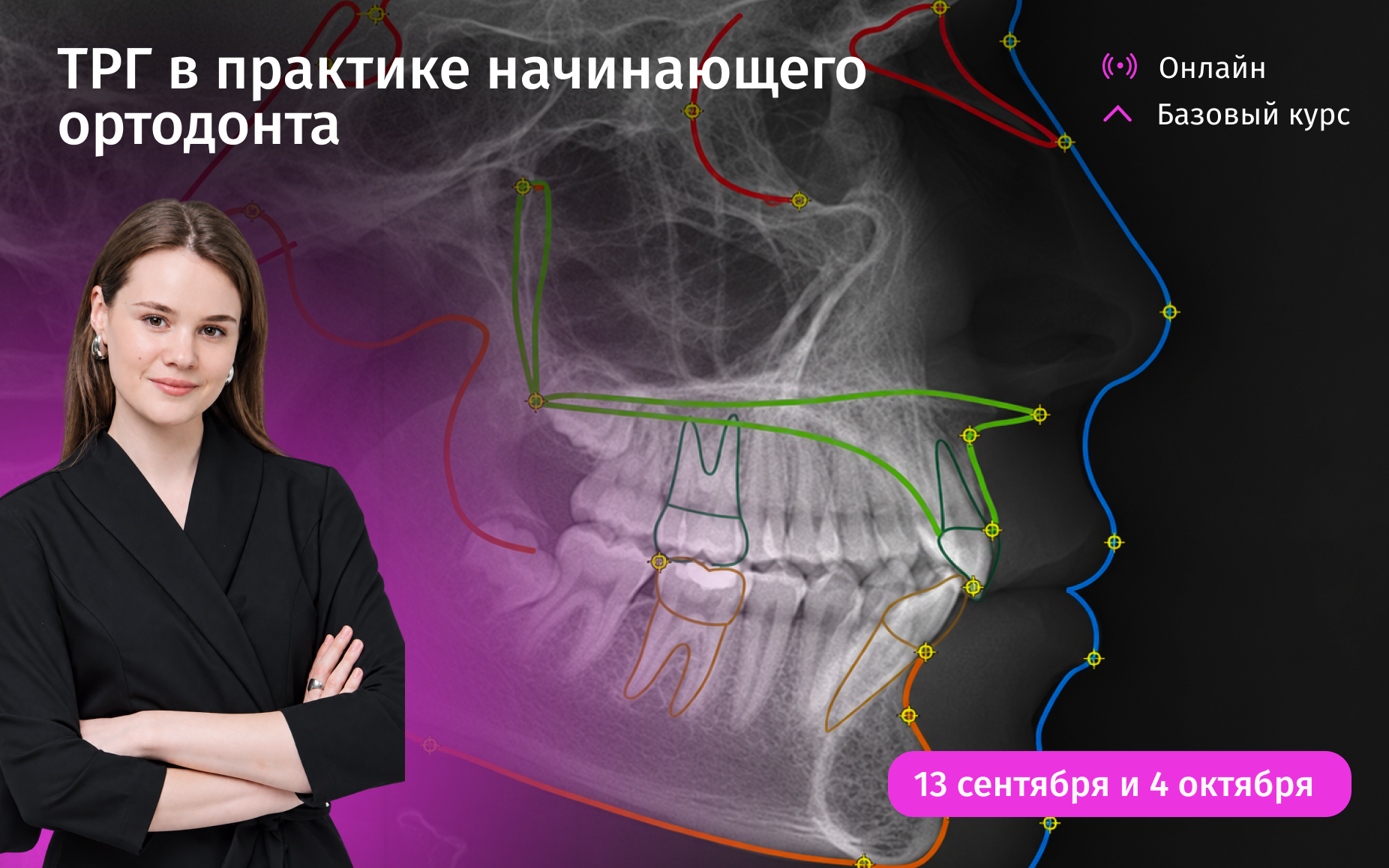 ТРГ в практике начинающего ортодонта