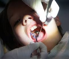 Абсцесс молочного зуба с интра- и экстраоральным синусовым трактом