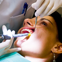 Анестезия при удалении зубов