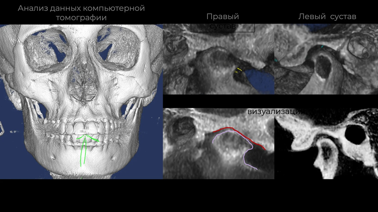 «Цифровая Гнатология. Новые алгоритмы»