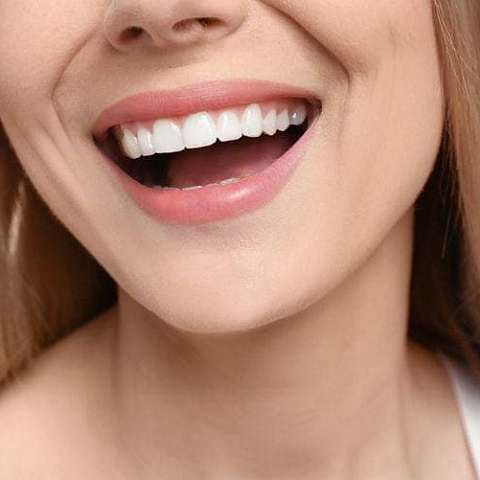 Композитные виниры - быстрое и надежное восстановление зубов
