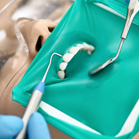 Зачем нужен коффердам при стоматологическом лечении?