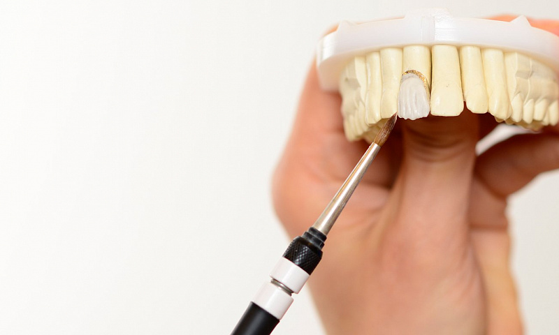 Перелом зуба — симптомы и методы лечения