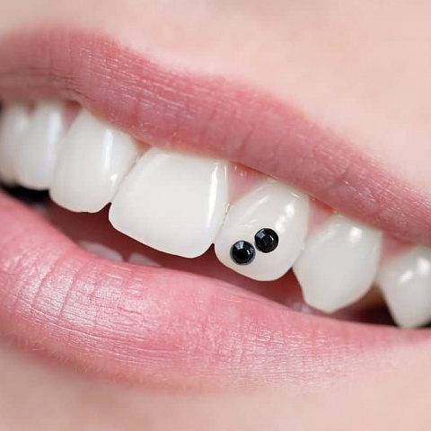 Что такое скайсы и вредно ли их устанавливать на зубы