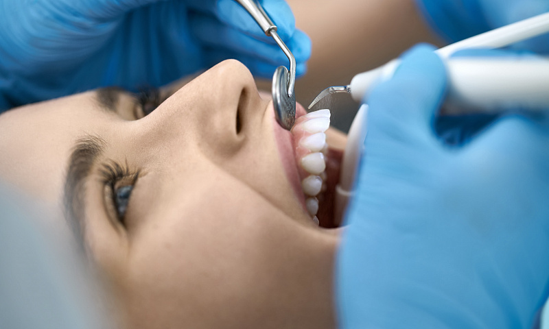 Эффективность ультразвуковой чистки зубов
