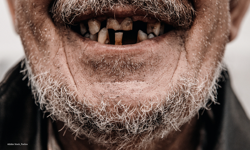 Фатализм приводи к потере зубов