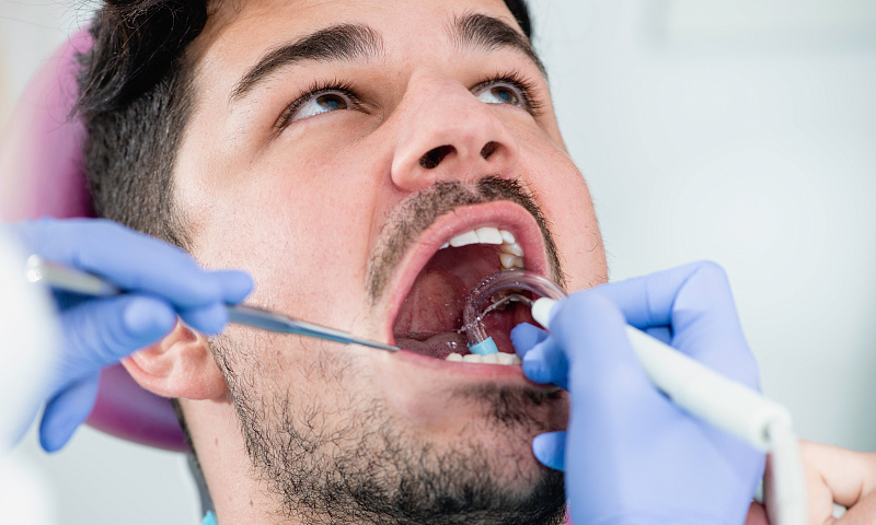 Исследования показывают, что у мужчин зубы хуже