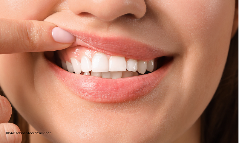 Дефекты генов приводят к порокам развития зубной эмали