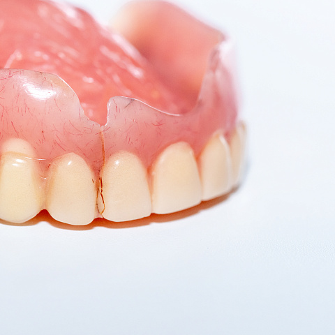 Что такое пластиночные зубные протезы?