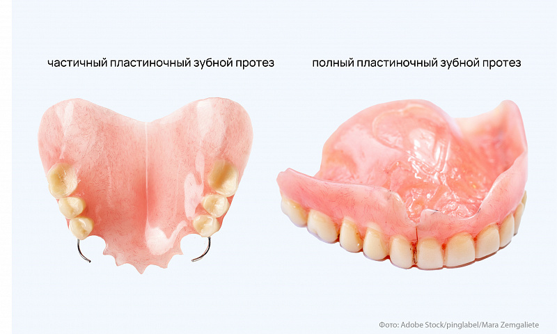 Что такое пластиночные зубные протезы?