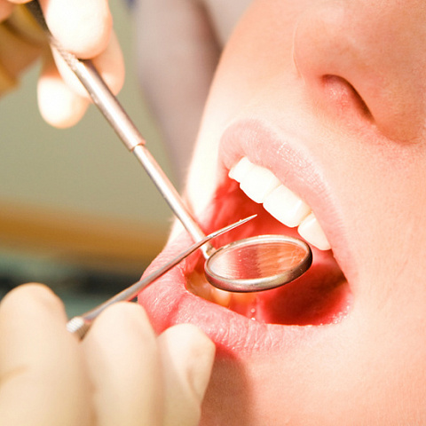 Индексы, применяемые при стоматологических осмотрах