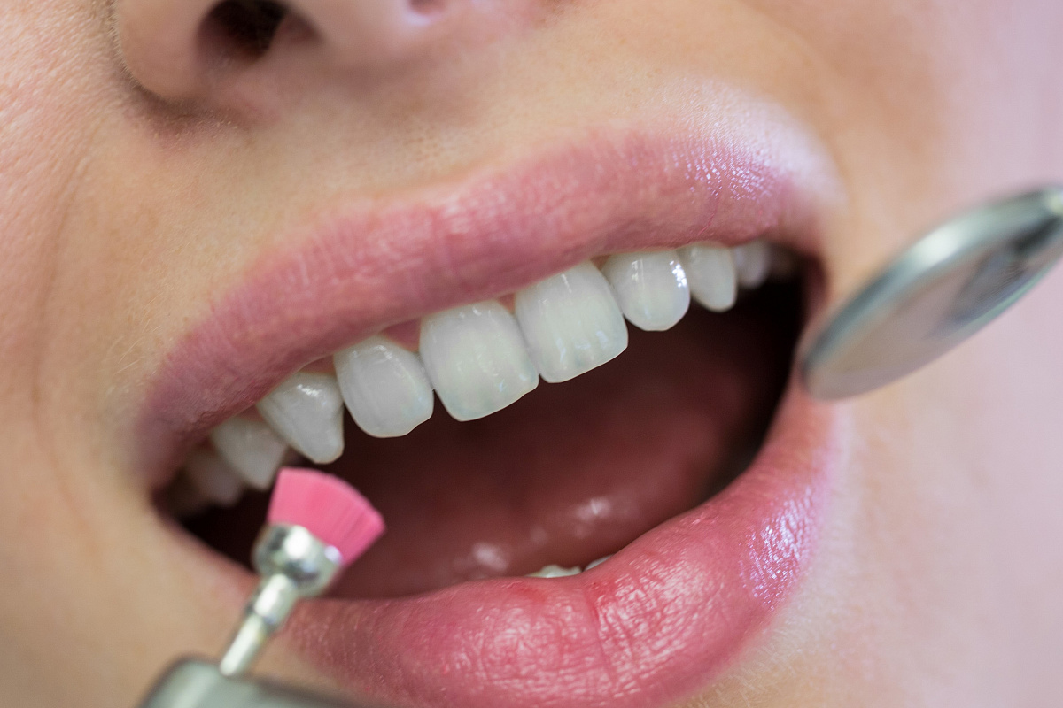 إزالة الجير