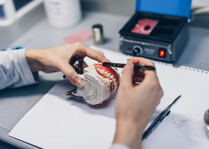 Тотальная имплантация, тотальное протезирование на имплантах . Функция и эстетика .