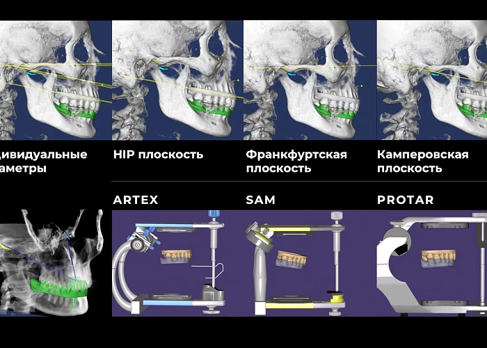 ЦИФРОВАЯ ГНАТОЛОГИЯ. Цифровые функциональные протоколы в диагностике и планировании ортопедического и ортодонтического лечения.