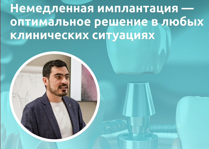 Немедленная имплантация - оптимальное решение в любых клинических ситуациях.