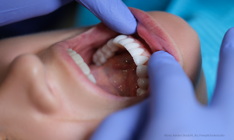 Биорепейр Зубная паста активная защита эмали зубов 75 мл (Biorepair, Отбеливание и лечение)