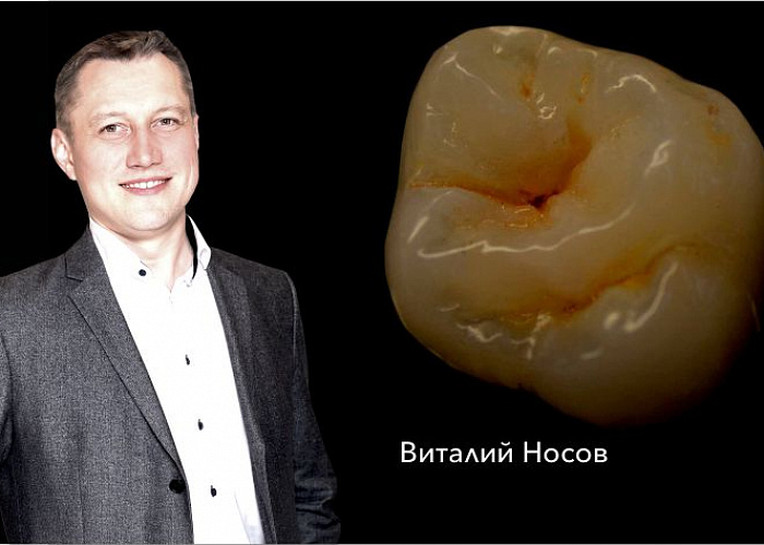 Практический курс! ФУНКЦИЯ И ЭСТЕТИКА. Клинико-лабораторные этапы изготовления виниров и коронок.