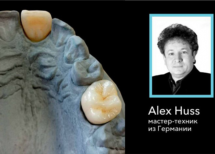 Практический курс! ИЗГОТОВЛЕНИЕ КОРОНОК И ВКЛАДОК МЕТОДОМ ПРЕССОВАНИЯ.