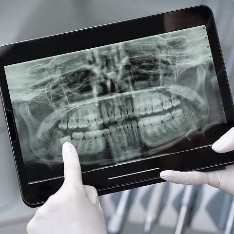 Установка рентгеновского оборудования в стоматологической клинике: требования, рекомендации