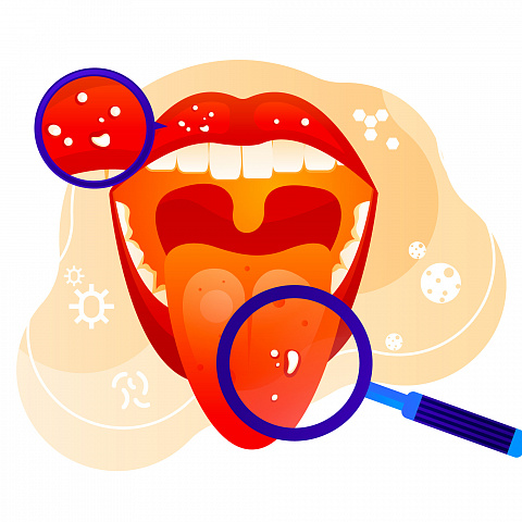 Заболевания слизистой оболочки полости рта: Симптомы, причины и современные методы лечения