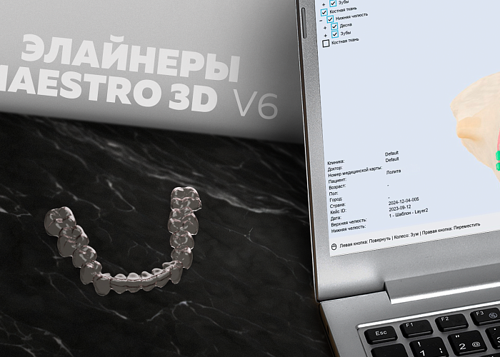 Элайнеры | Maestro 3D V6 в практике врача-ортодонта и зубного техника
