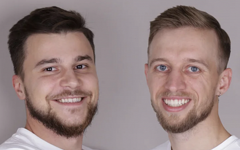 Тотальные работы на имплантах